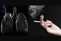 El tabaquismo puede desencadenar cáncer de páncreas