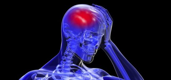 Los retos de sobrevivir a un infarto cerebral