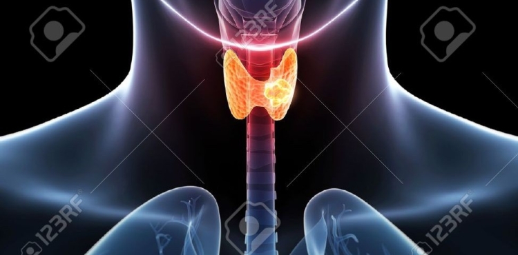 Cáncer de tiroides: ¿Mujeres tienen más riesgo? - Mayo Clinic