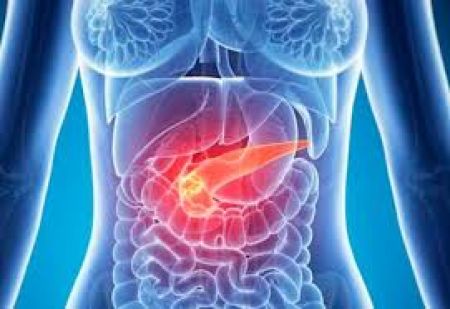 Investigadores de Mayo Clinic identifican gen que predeciría cáncer pancreático en personas con diabetes tipo II
