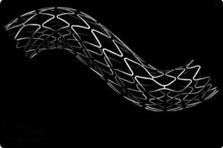 El stent con recubrimiento de titanio-óxico nítrico (TiNO) no es inferior al stent leberador de everolimus (EES), según estudio