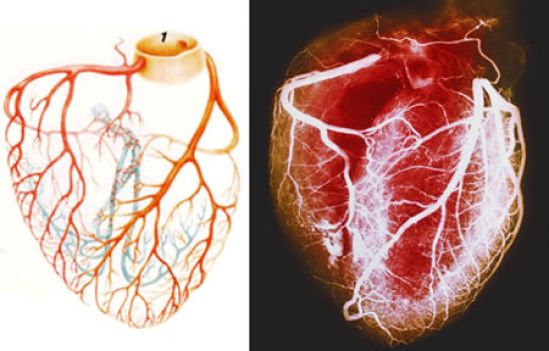 Novedosa técnica mejora el tratamiento de enfermedades cardiovasculares 