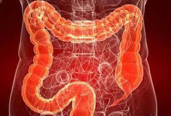Colitis Ulcerosa, una enfermedad incomprendida, señalan expertos