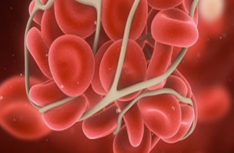 Estudios demuestran resultados positivos con tratamiento para pacientes con hemofilia A