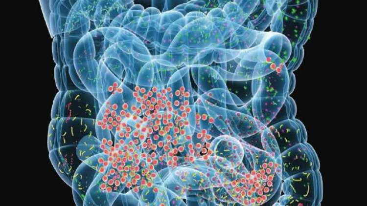 Influye microbiota intestinal en desarrollo de obesidad e hígado graso no alcohólico, especialista de la UNAM