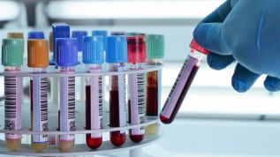 OPINIÓN :: Calidad en los laboratorios clínicos: un proceso de mejora continua que falta documentar