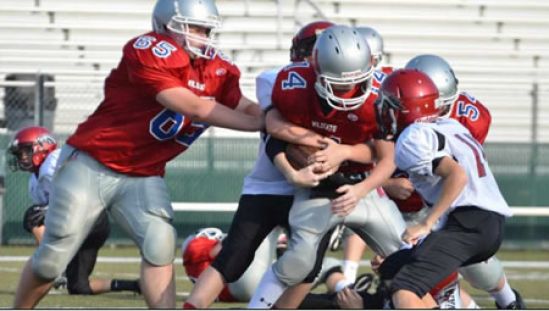 ¿Sabías qué la conmoción cerebral es una lesión del cerebro?