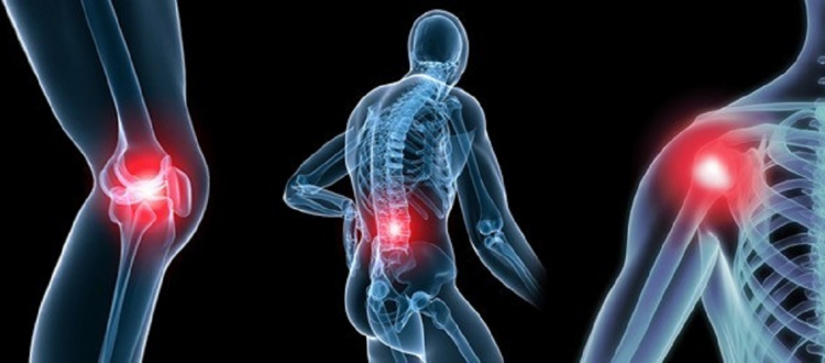 Sobrecarga articular, un riesgo para padecer osteoartritis