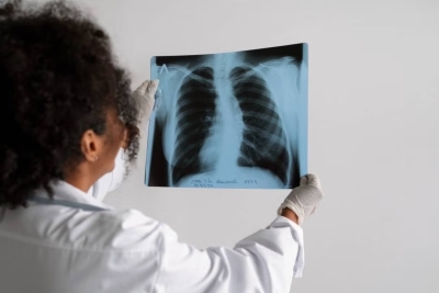 El diagnóstico temprano del cáncer es clave para reducir la mortalidad en México