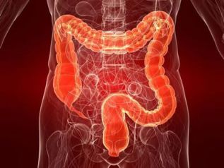 Jornada de investigación en enfermedad inflamatoria intestinal