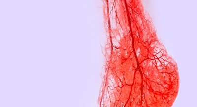 Reducción de amputaciones mediante técnicas avanzadas de revascularización