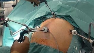 Cirugía Bariatrica, un camino viable frente a la actual epidemiológica nacional