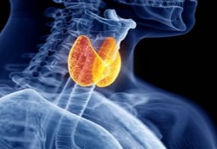 La mayoría de los casos de cáncer de tiroides son curables