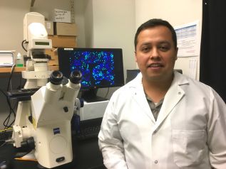 Proteina epitelial ZO-2 punto de inflexión en terapias contra el cáncer