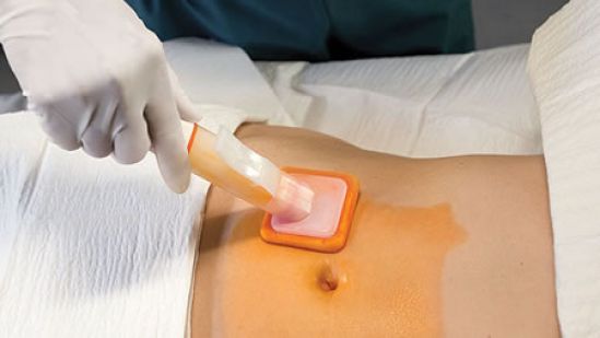 Alrededor del 8.7% de pacientes hospitalizados presentaba infecciones nosocomiales