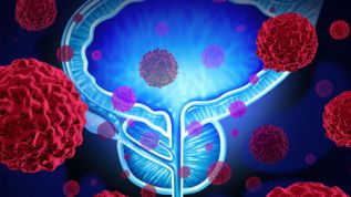 “Toma las riendas” campaña que invita a ser más activos en la lucha contra el cáncer de próstata