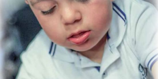 México se suma a la conmemoración del Día Internacional de las mucopolisacaridosis (MPS)