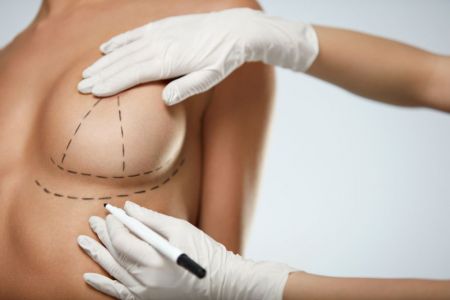 La cirugía para reducción de mamas puede aliviar el dolor de espalda y cuello