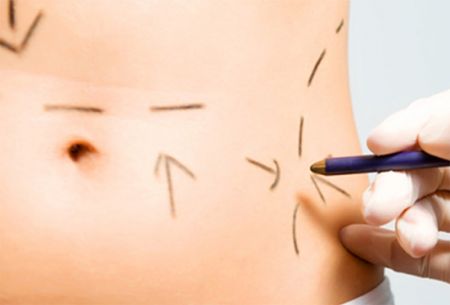 Clínicas de cirugía estética operan sin autorización sanitaria