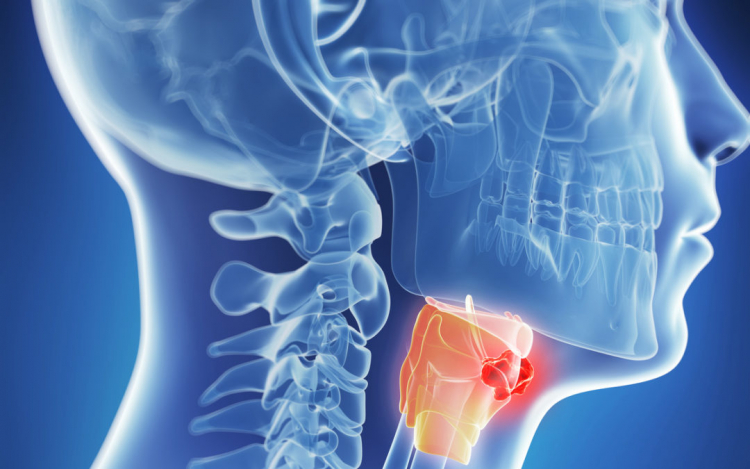 Detectar anomalías en boca y cuello podría prevenir el desarrollo de este tipo de cáncer