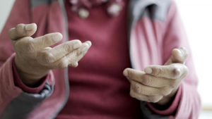 La probabilidad de un ataque al corazón se eleva un 60% en pacientes con artritis reumatoide
