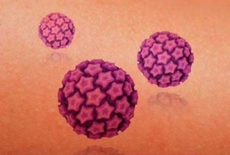Importancia del análisis de virus de papiloma humano y el examen de Papanicolaou