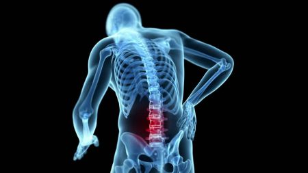 Dolor lumbar: tratamiento y prevención