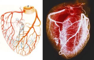 Encuentran relación entre quimioterapia y daño cardíaco