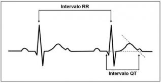 Síndrome del intervalo QT largo