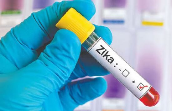 Siemens lanza nueva prueba para la detección del virus Zika