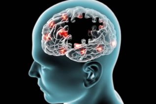 Creación de “Código cerebro”, vital para la atención adecuada del infarto cerebral
