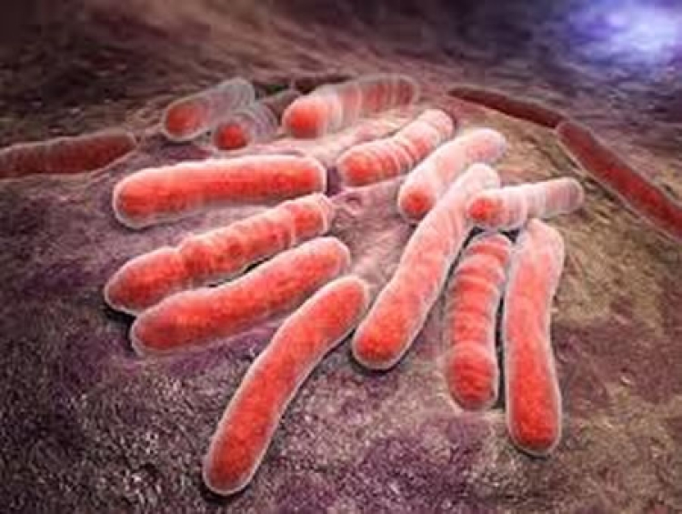 VIH por Tuberculosis: la innovación en pruebas diagnosticas pueden ayudar en el diagnóstico precoz de la coinfección en pacientes seropositivos