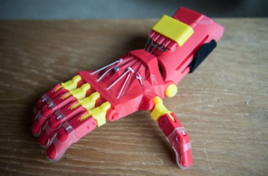 Nuevas prótesis 3D, personalizables y accesibles, para atender amputaciones parciales