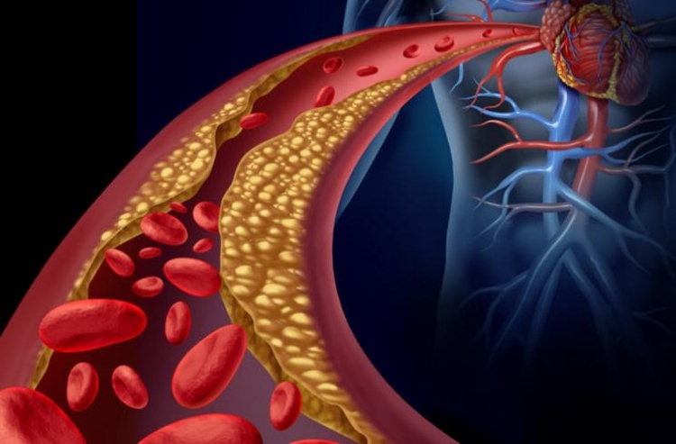 Cuatro maneras de ayudar a reducir el riesgo de enfermedades del corazón