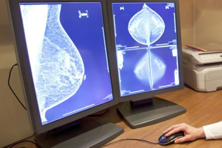 El diagnóstico del cáncer de mama a través de la patología
