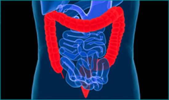 La vida de un paciente con cáncer colorrectal