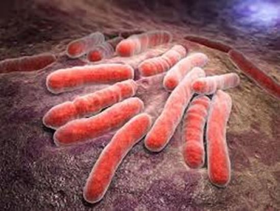 Erradicar la tuberculosis continúa siendo un reto en México