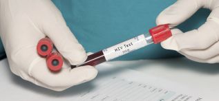 OPS insta a hacerse la prueba de VIH como primer paso para prevenir el sida y detener la epidemia