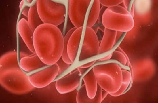 Hemofilia adquirida, una variedad poco conocida