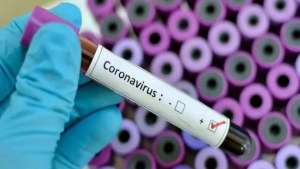 UNAM alerta sobre la posible llegada del coronavirus en semanas próximas