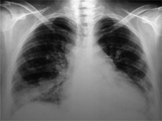 Para la salud de sus pulmones elija, dentro de lo posible, productos de limpieza con menos sustancias químicas tóxicas
