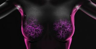 Cáncer de mama, diagnóstico oportuno a través de la Inteligencia Artificial