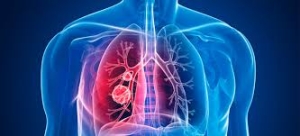 El cáncer en la era digital   