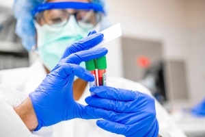 Terapia génica muestra resultados iniciales positivos en pacientes con anemia falciforme tratados en un ensayo clínico del Cleveland Clinic Children's