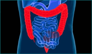 ¿Cómo puedo reducir el riesgo de cáncer de colon?