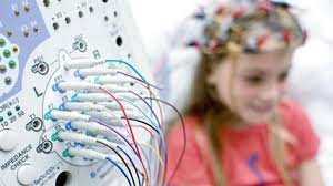 Más de la mitad de mexicanos que padecen epilepsia son niños menores a 2 años