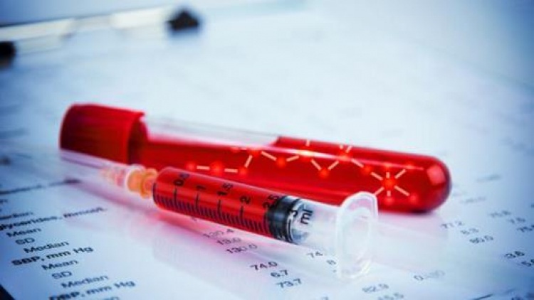 Profilaxis clave para mejorar la calidad de vida de una persona con hemofilia