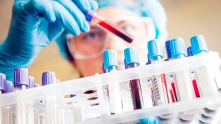 Presentan análisis de ADN para detectar cáncer de hígado