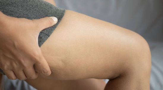 Dile adiós a la celulitis con 5 sencillos ejercicios