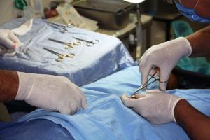 Por qué la vasectomía es una buena opción anticonceptiva